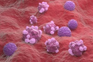International team examines how selenium could help in fight against ovarian cancer