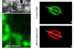 De l'or pour lutter contre le cancer 
