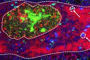 Nano-imagerie des éléments traces : application aux maladies neuro-dégénératives